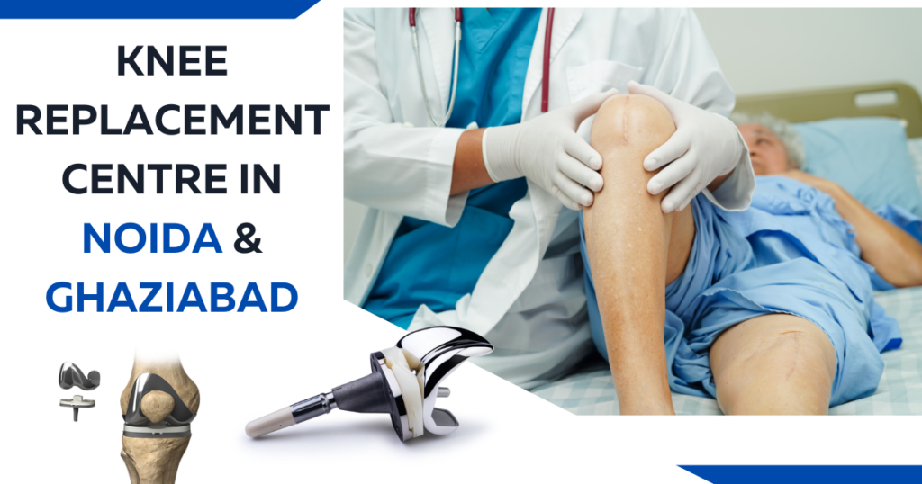 Knee Replacement Center in Noida