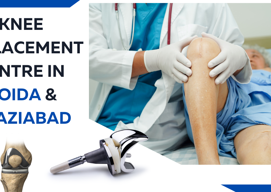 Knee Replacement Center in Noida